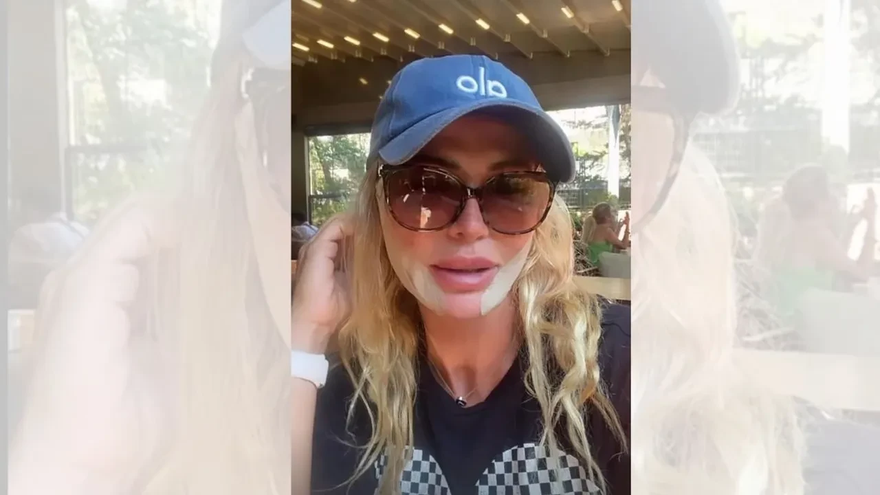 Nagihan Karadere Survivor parasını estetiğe verdi! Yüzünü komple yaptırdı
