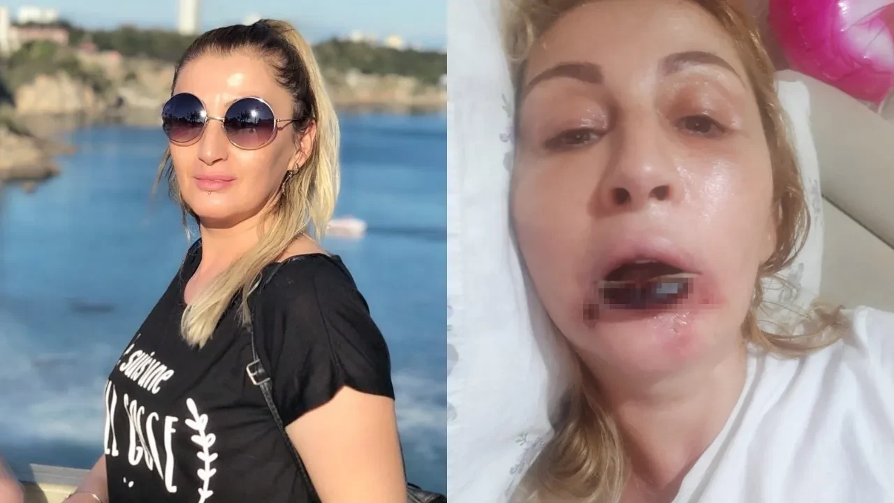Güzelleşmek isterken hayatı karardı: 7 yıldır adliye koridorlarında adalet arıyor