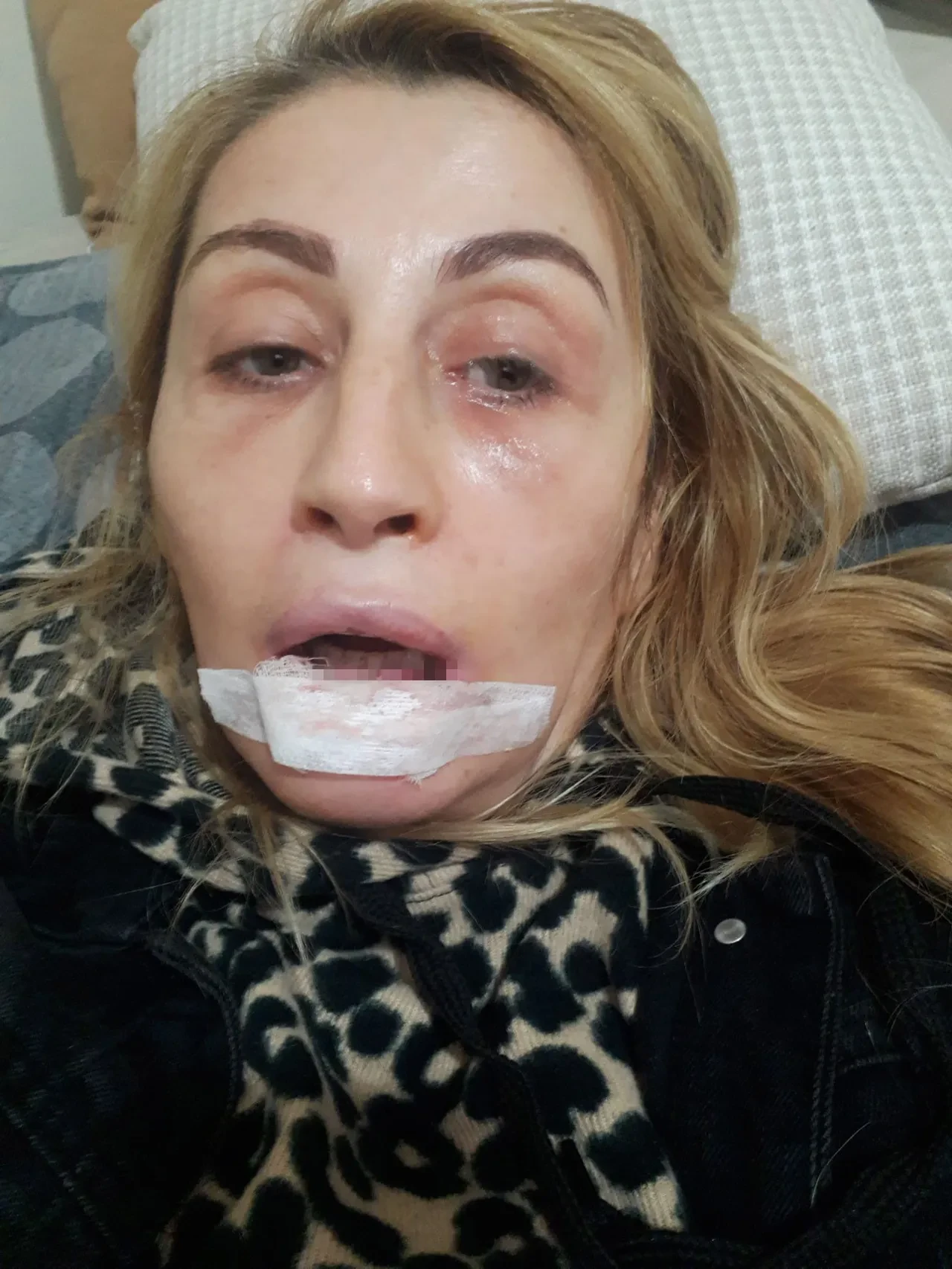Güzelleşmek isterken hayatı karardı: 7 yıldır adliye koridorlarında adalet arıyor
