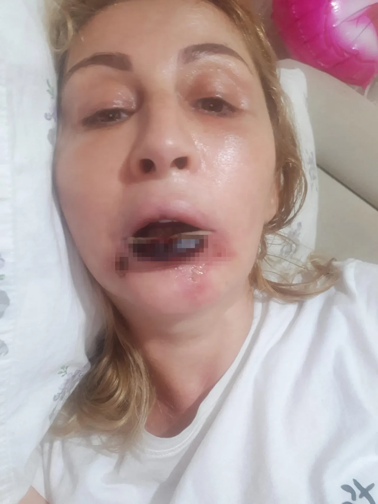 Güzelleşmek isterken hayatı karardı: 7 yıldır adliye koridorlarında adalet arıyor