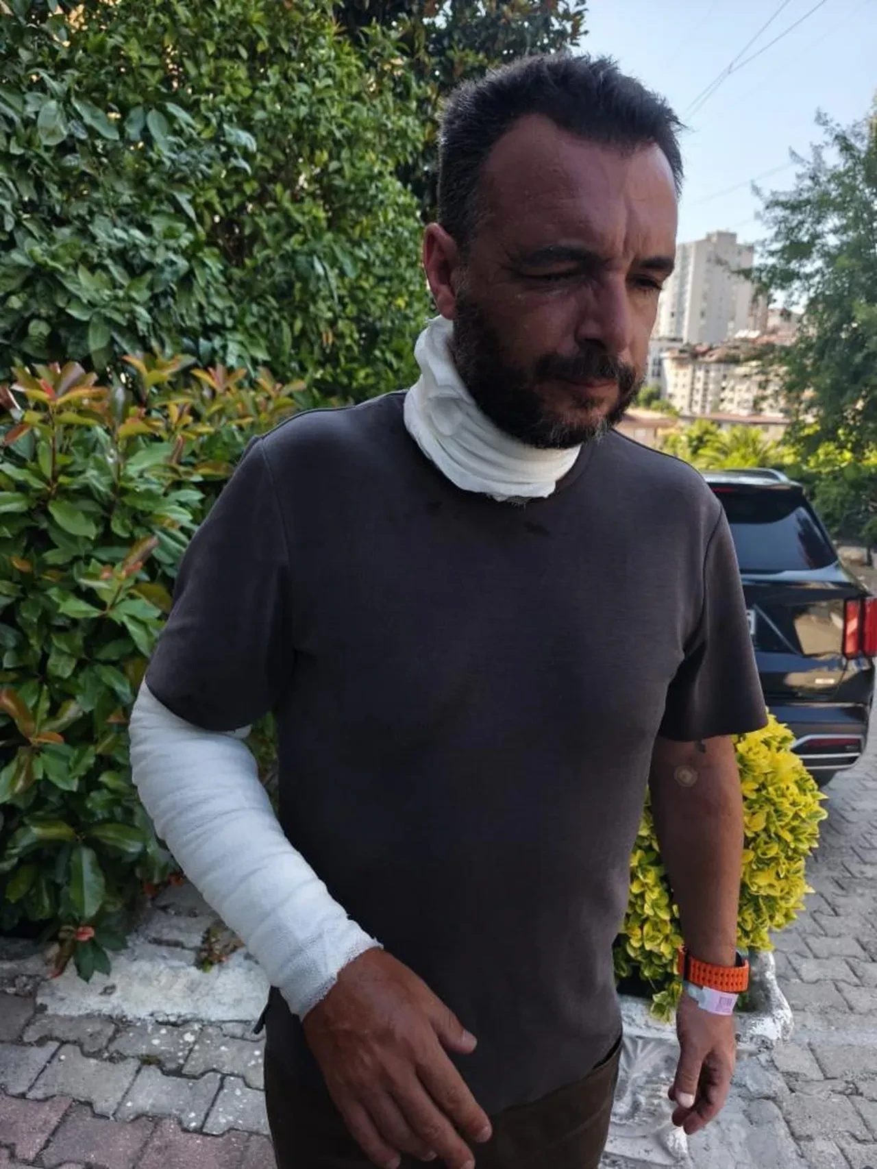 Ümraniye'de yüksek gerilim hattı faciası: Tel koptu, yangın çıktı, bir kişi yaralandı