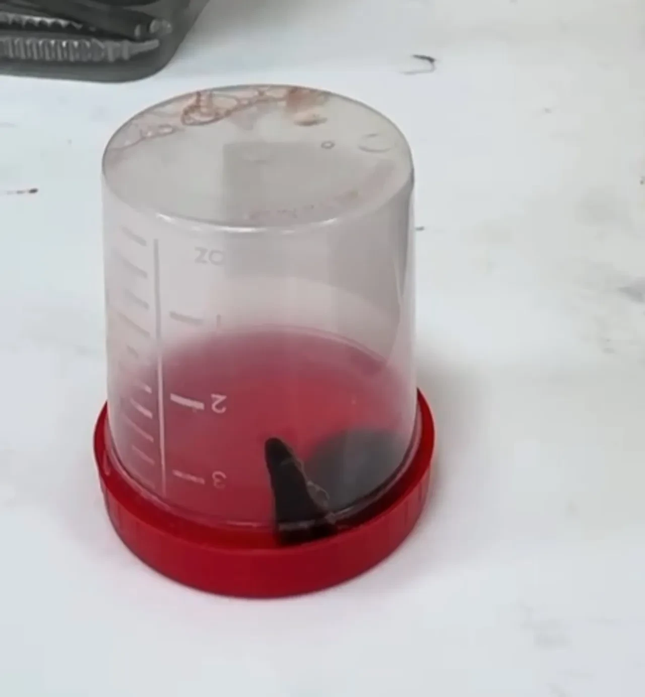 Tam 10 gün sonra ortaya çıktı! Ailesi küçük çocuğun boğazından çıkanı görünce şok geçirdi