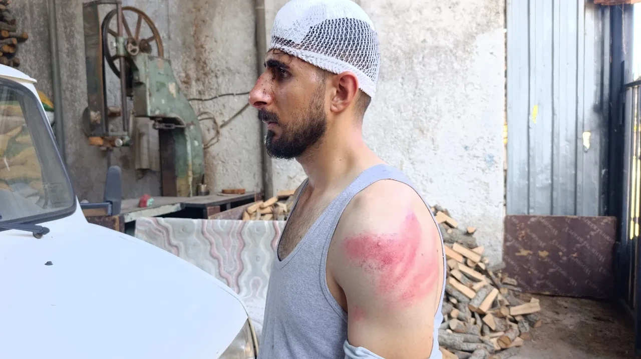 Trafikte yavaş gitti, dehşeti yaşadı! Aracı durdurup öldüresiye dövdüler: Burnu kırıldı, başına 8 dikiş atıldı