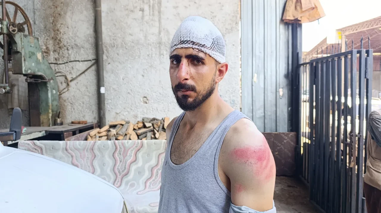 Trafikte yavaş gitti, dehşeti yaşadı! Aracı durdurup öldüresiye dövdüler: Burnu kırıldı, başına 8 dikiş atıldı