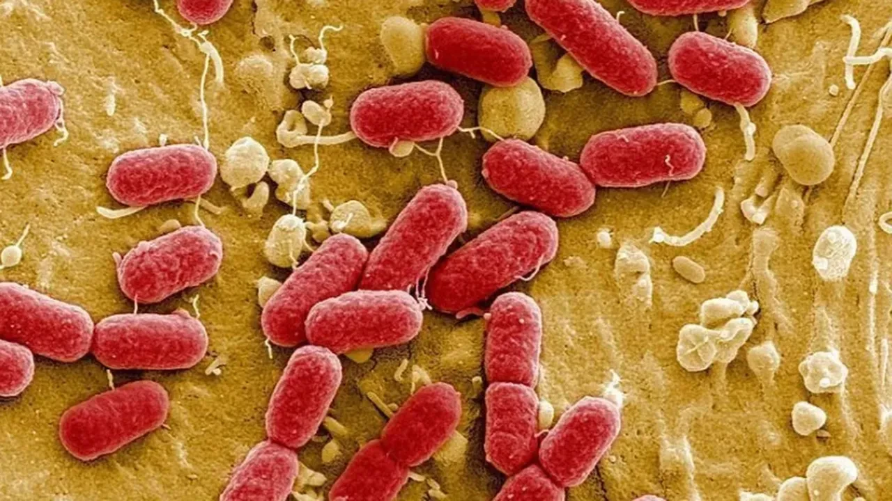 Ebola virüsünde korkutan tablo! Mehmet Ceyhan uyardı: Belirtileri griple neredeyse aynı!