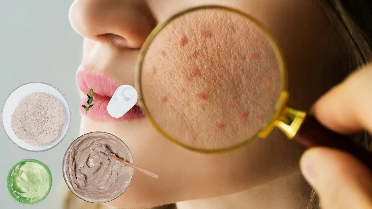 Dermatologdan öğrendim, cildim 1 haftada düzeldi! Cilt problemine göre doğal yüz maskesi bakım rutini