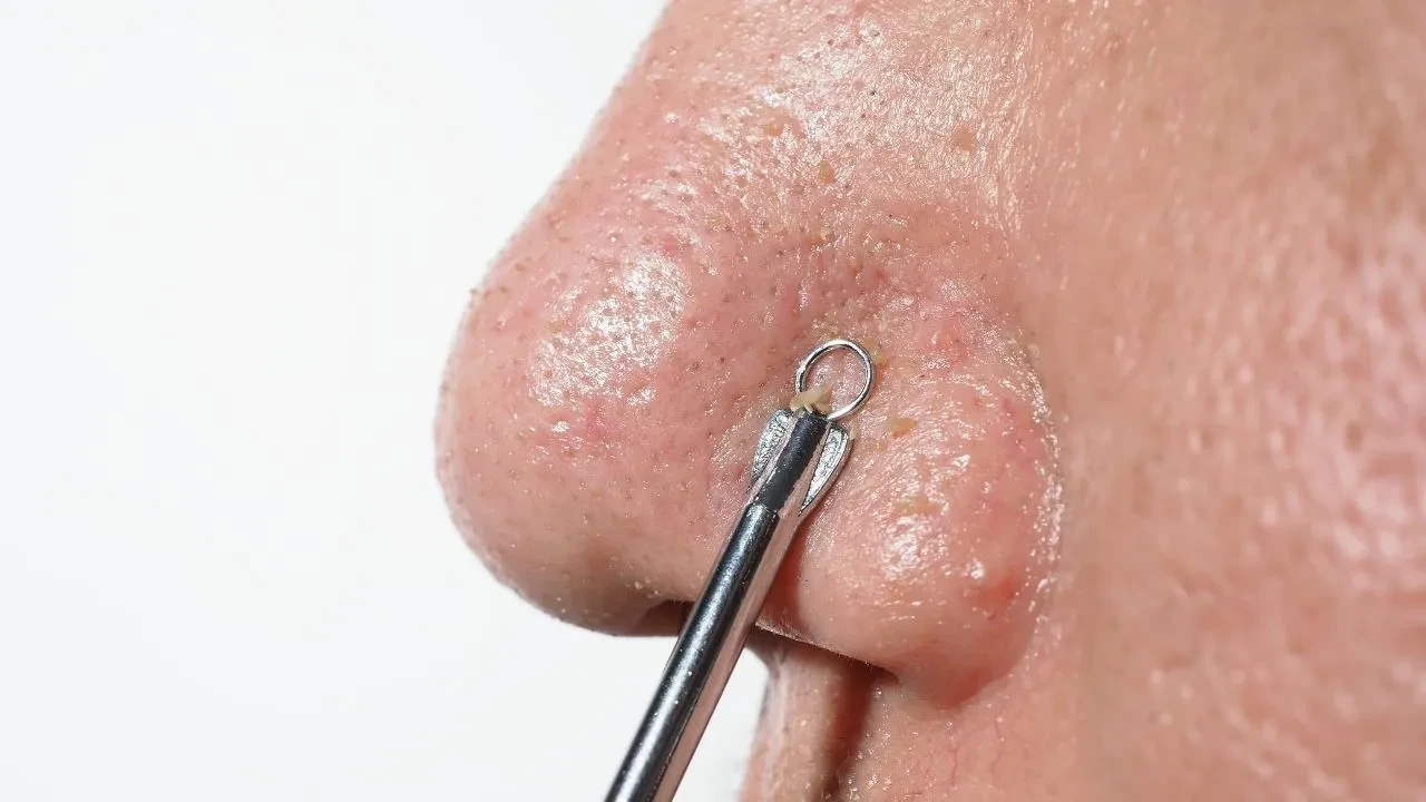 Dermatologdan öğrendim, cildim 1 haftada düzeldi! Cilt problemine göre doğal yüz maskesi bakım rutini