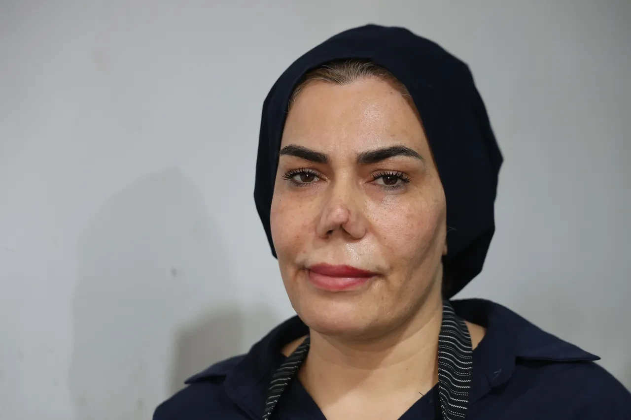 Hatalı ameliyat kâbusu: Kırılan burnu için 4 kez bıçak altına yattı, hayatı karardı