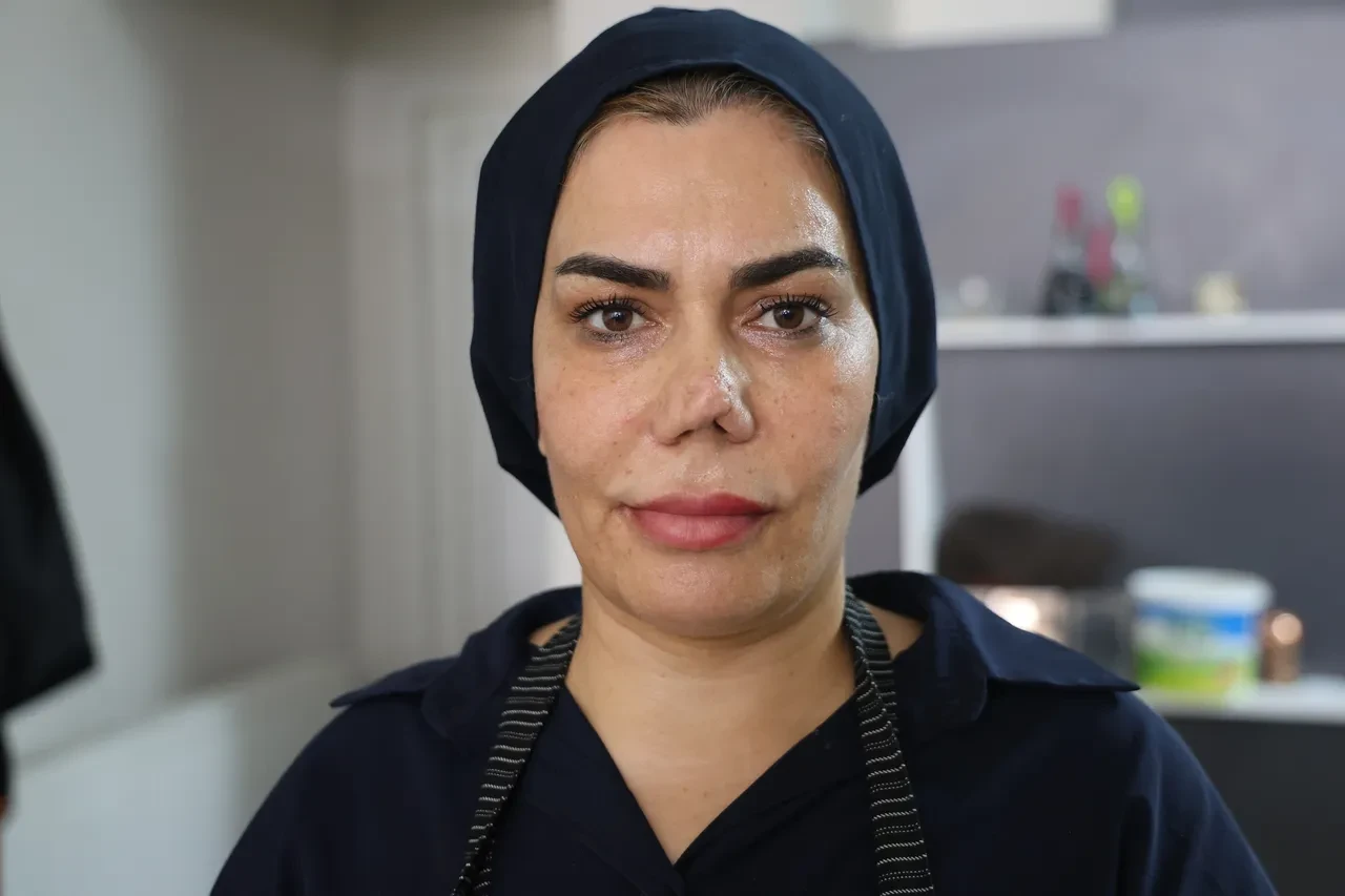 Hatalı ameliyat kâbusu: Kırılan burnu için 4 kez bıçak altına yattı, hayatı karardı