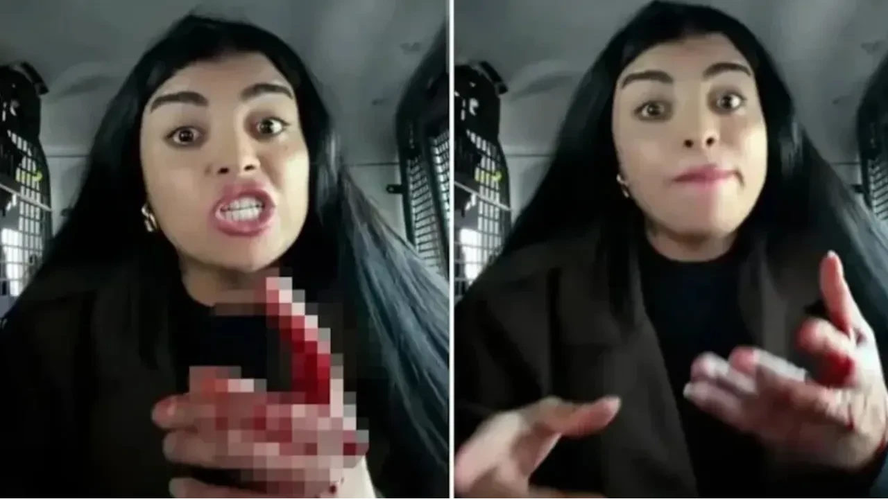 Canlı yayın açıp genç kadını yüzünden bıçaklamıştı: 'Karagül' lakaplı Tiktok fenomeni tahliye edildi