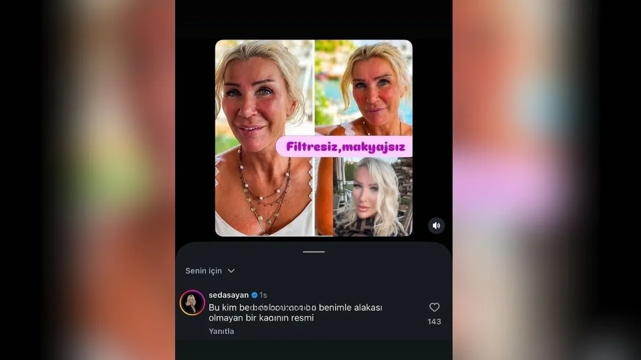 Seda Sayan’dan “Filtresiz Hali” fotoğrafa jet yanıt! “Benimle alakası olmayan bir kadın”