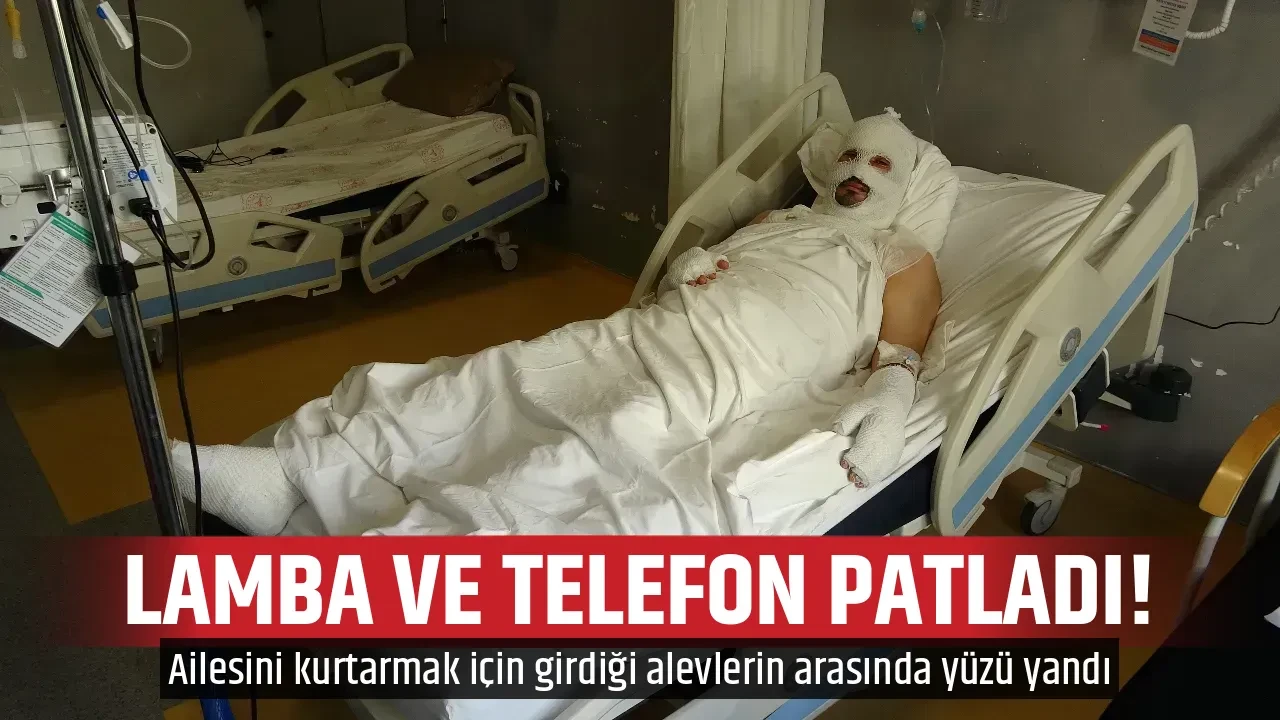LAMBA VE TELEFON PATLADI!