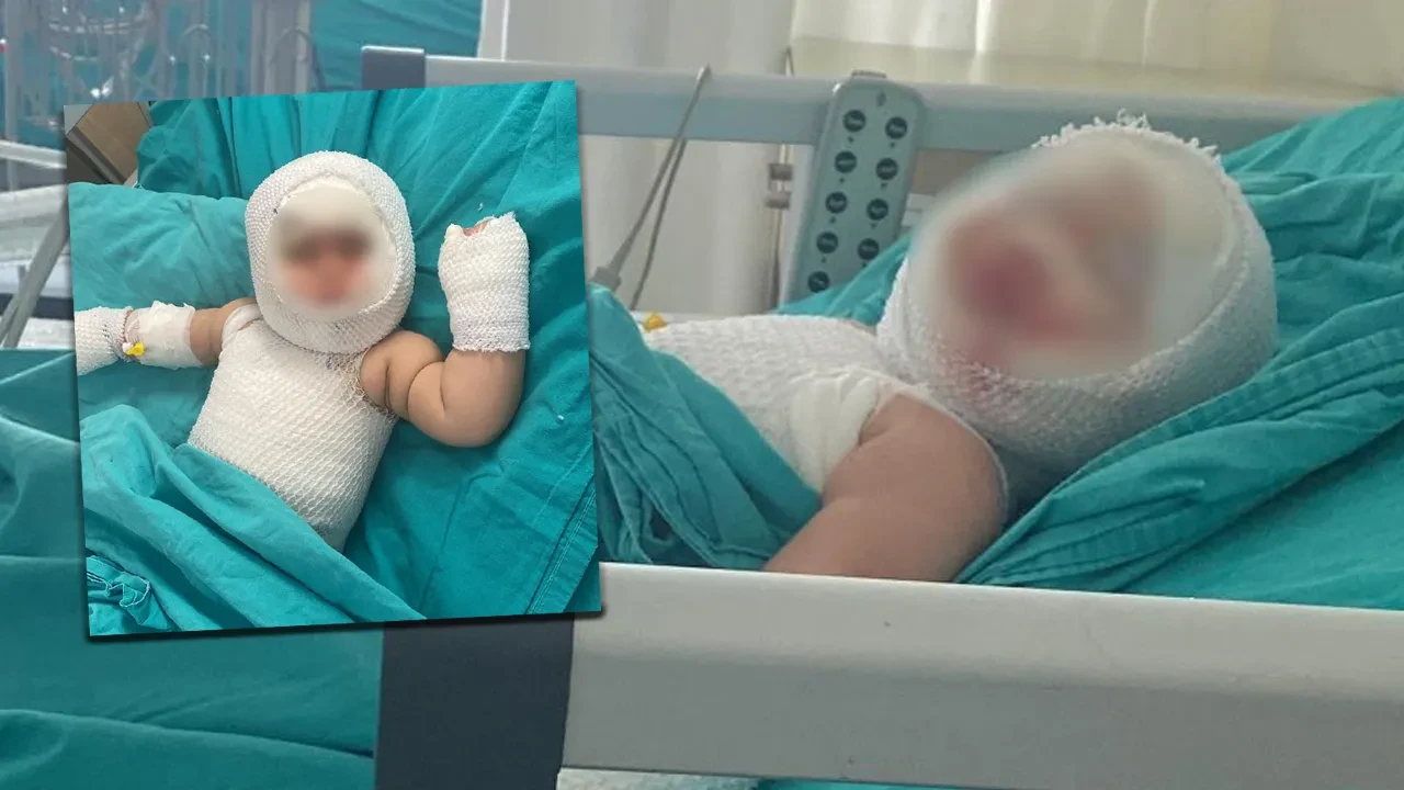 9 aylık bebek misafirlikte dehşeti yaşadı! Domates konservesi patladı, vücudu yandı
