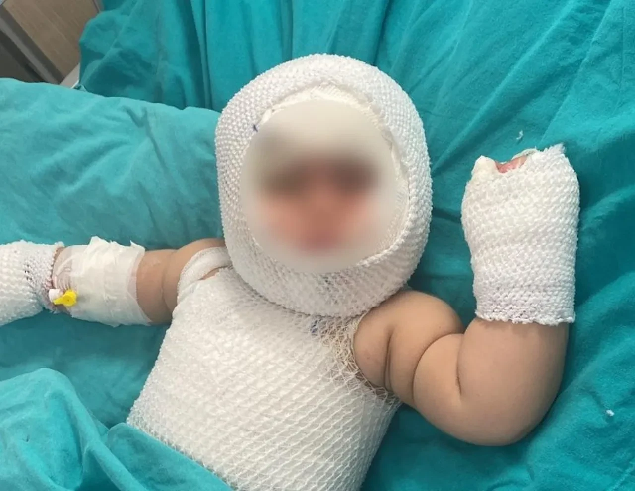 9 aylık bebek misafirlikte dehşeti yaşadı! Domates konservesi patladı, vücudu yandı