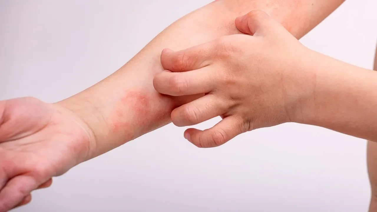 Mantar ve egzama şikayetine son! Banyo suyuna 2 kaşık ekleyin