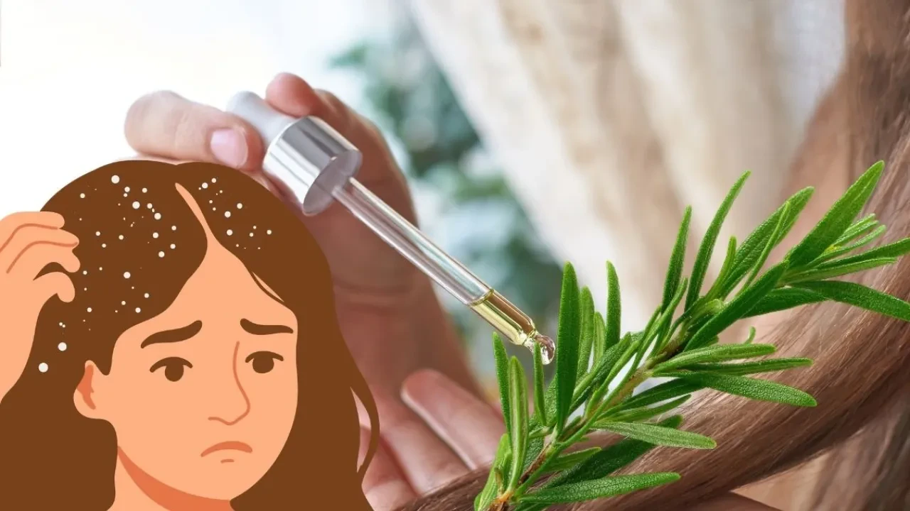 Saç dibindeki yağlanma egzama habercisi! Biberiye suyunu yeni keşfettim