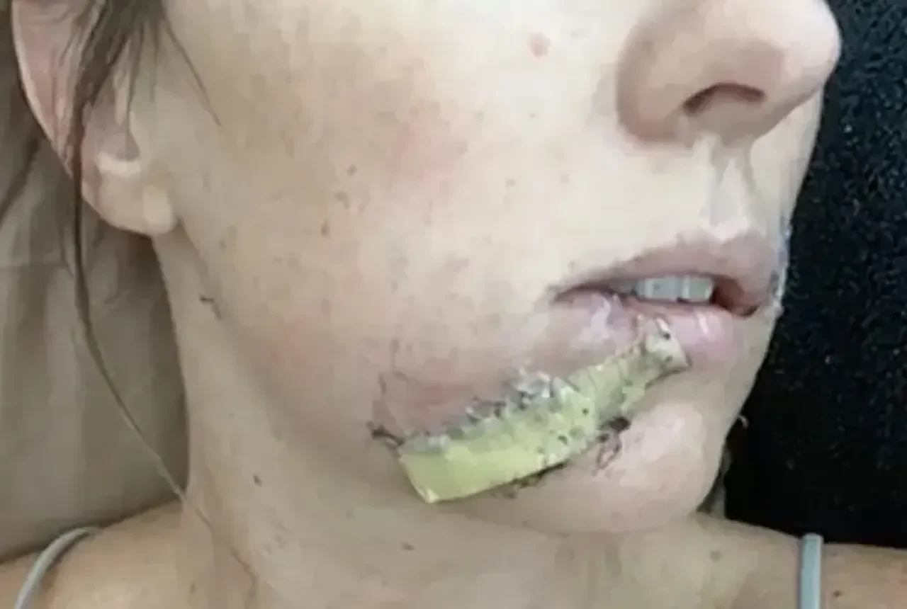 Anne, 4 yaşındaki kızını kurtarmak için kır kurduyla boğuştu! Neler yaşadığını bir bir anlattı