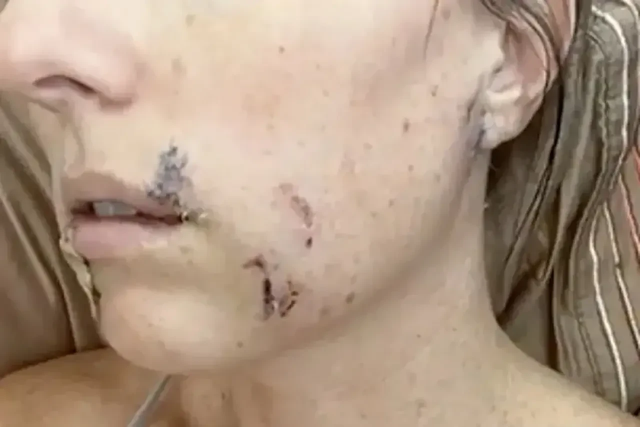 Anne, 4 yaşındaki kızını kurtarmak için kır kurduyla boğuştu! Neler yaşadığını bir bir anlattı