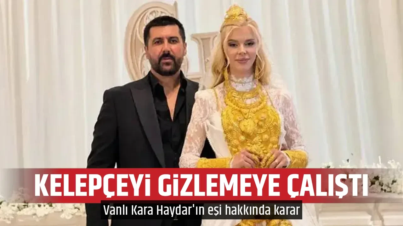 KELEPÇEYİ GİZLEMEYE ÇALIŞTI