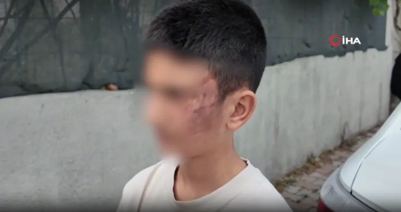 Arnavutköy’de 12 yaşındaki epilepsi hastası çocuğa akran zorbalığı: 3 şüpheli gözaltında