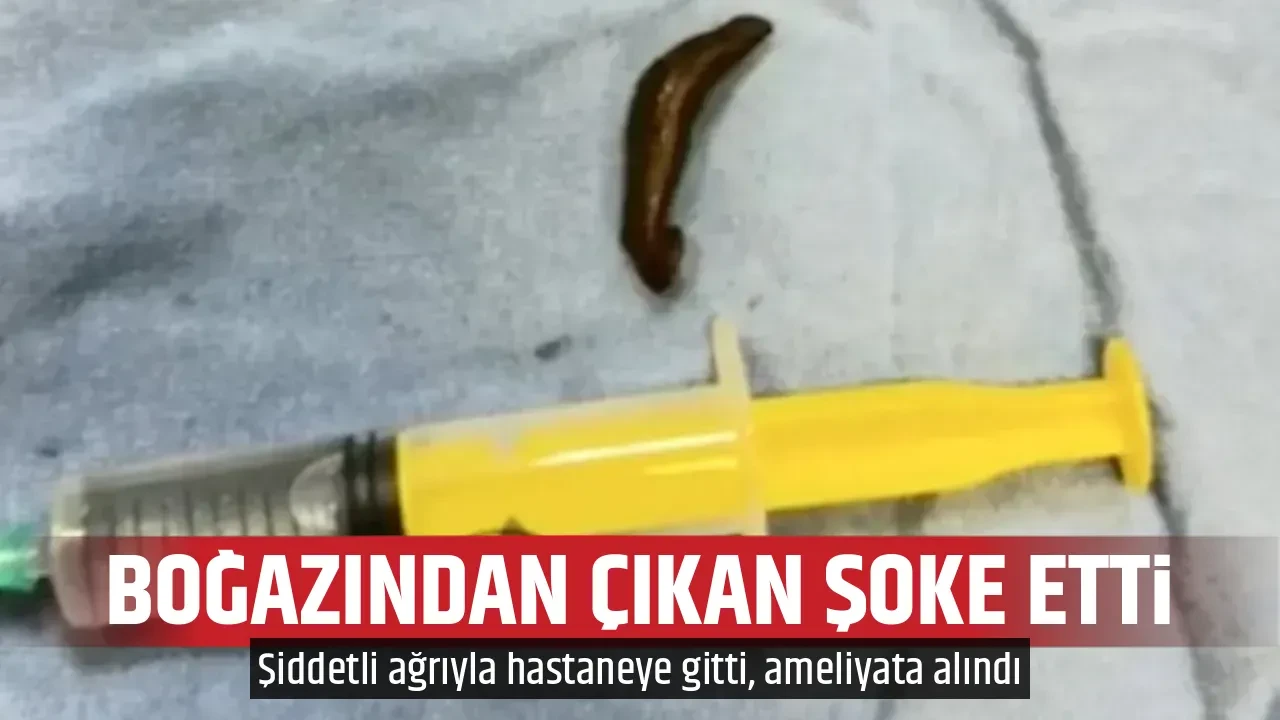 BOĞAZINDAN ÇIKAN ŞOKE ETTİ