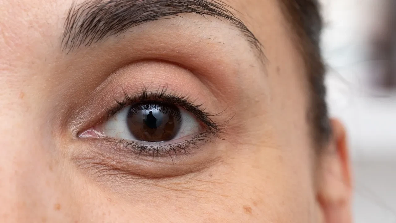 Göz altı morlukları nasıl geçer? Keten tohumu ve kahveyle doğal bakım