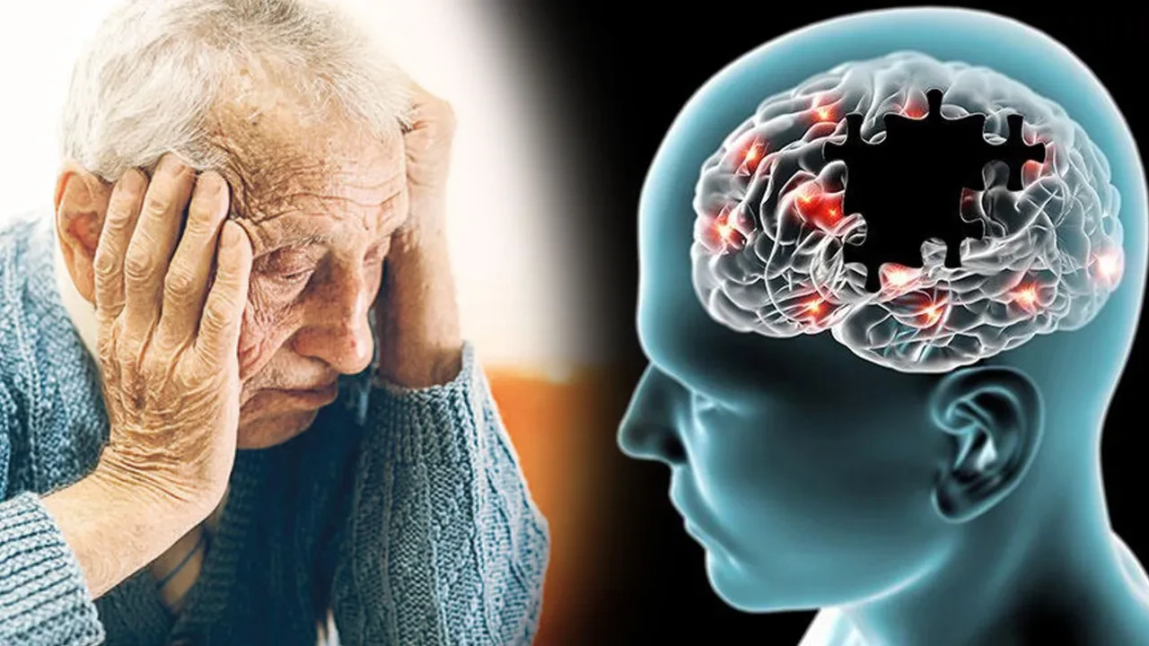 Araştırmalar ortaya çıkardı: İşte Alzheimer riskini düşüren yiyecek