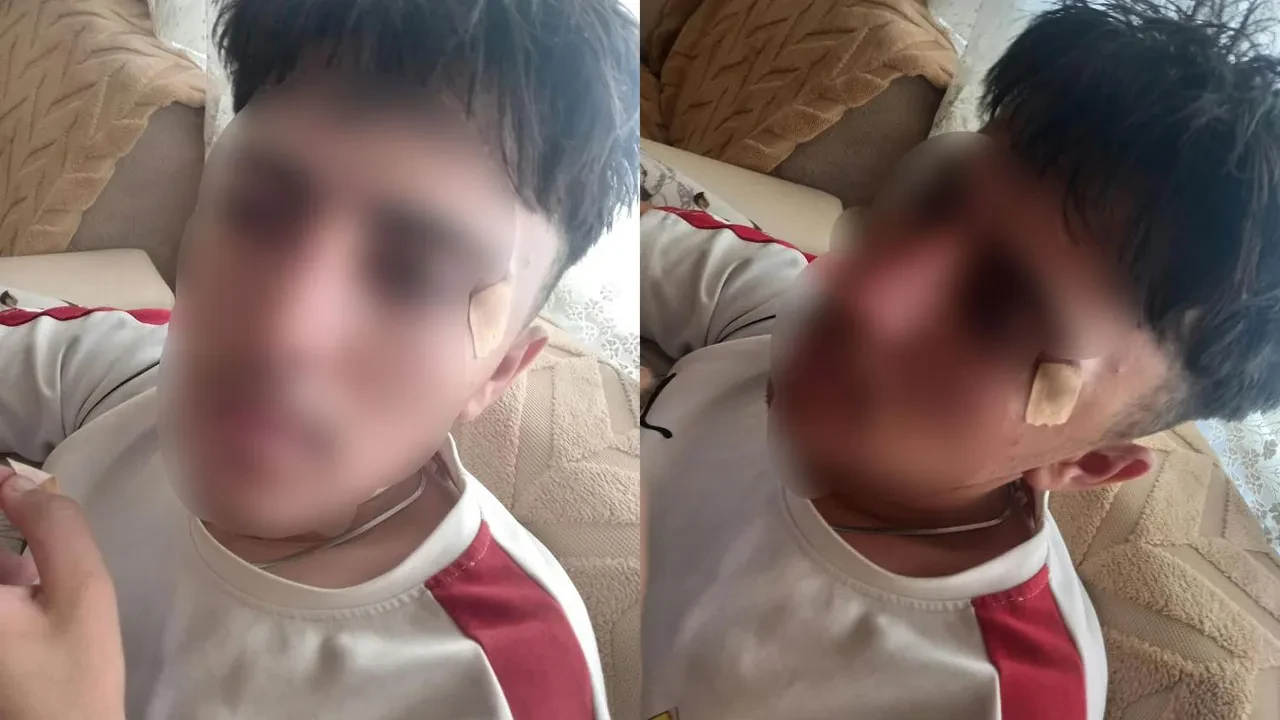 Afyonkarahisar'da eğitim merkezinde skandal iddia: Öğretmenin kafa attığı 16 yaşındaki öğrencinin burnu kırıldı