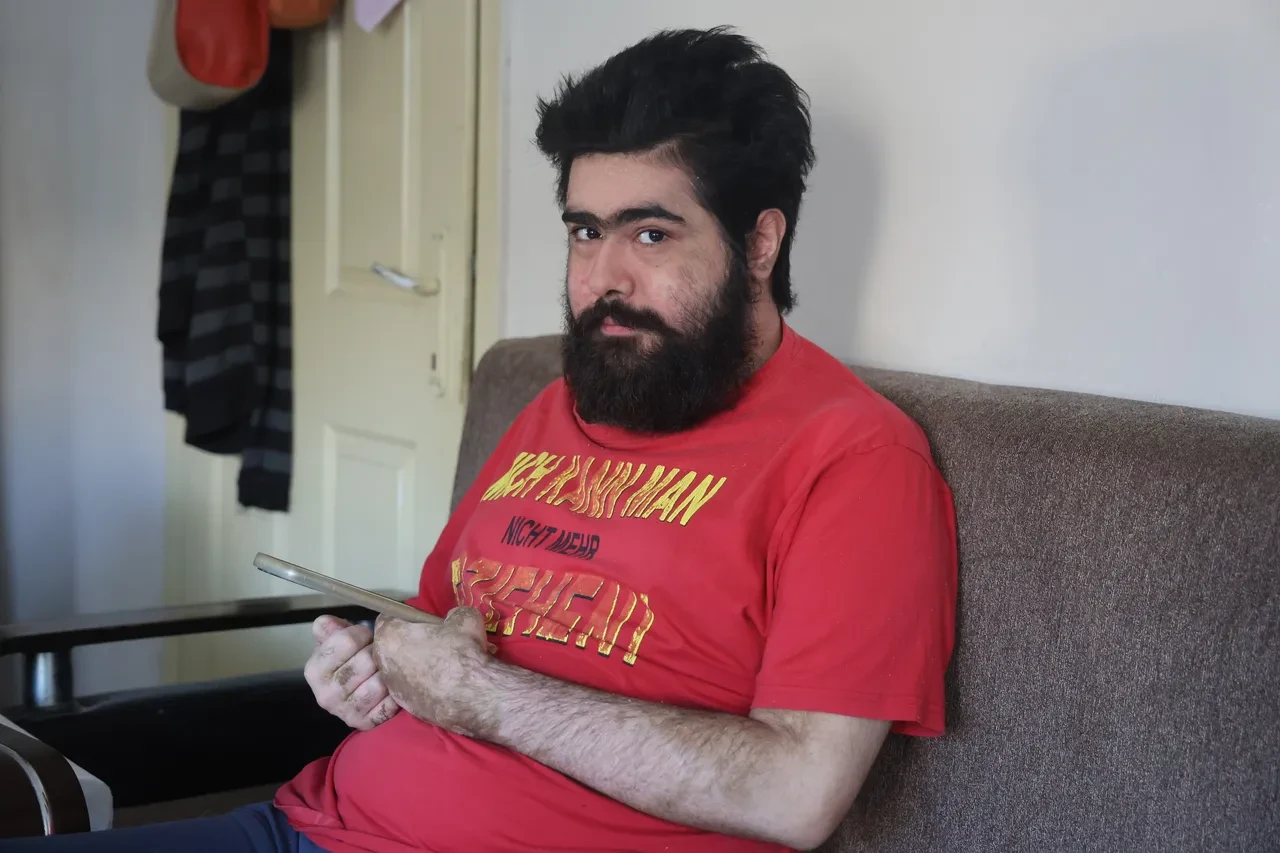 Yıllarca duş almamış, tırnaklarını kesmemişti! Barış Özbay'ın son hali yürek burktu