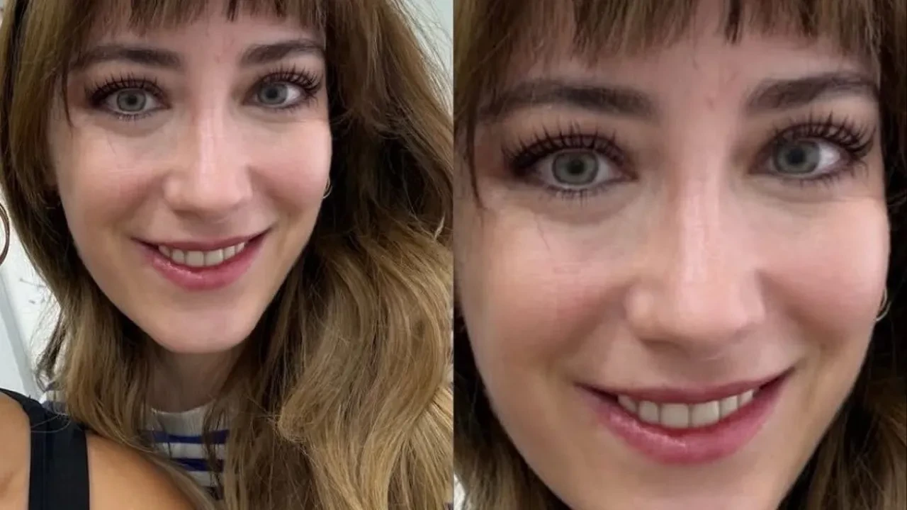 Hazal Kaya'yı görenler tanıyamadı! Elmacık kemiğinden göz altı torbalarına burnuna kadar yaptırmış