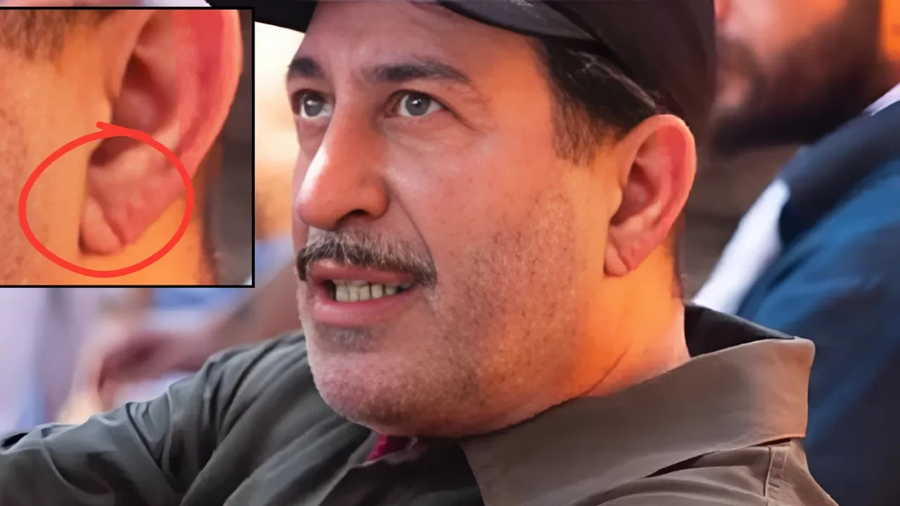 Cem Yılmaz kalp krizi sonrası eridi bitti! 1 haftada verdiği kilo ile dikkat çekti