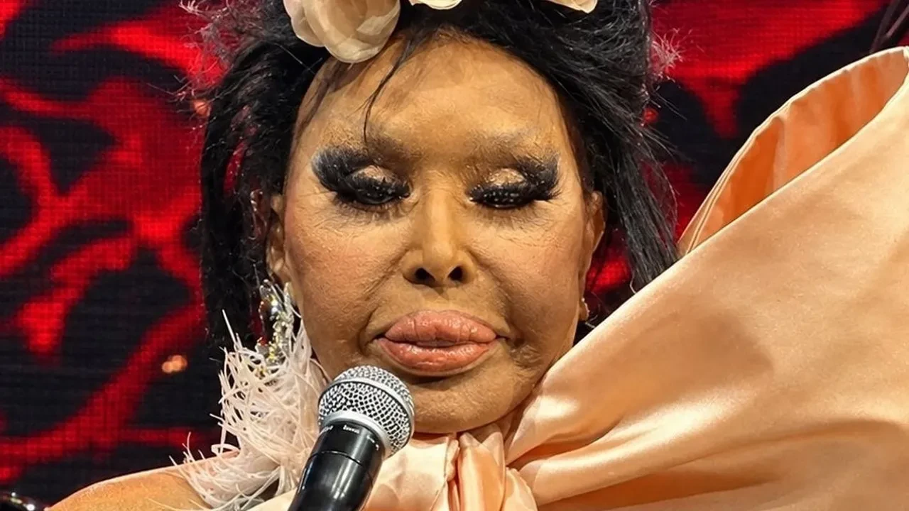 Bülent Ersoy lolita estetiği sonrası ortaya çıktı! Son hali görenleri şaşırttı
