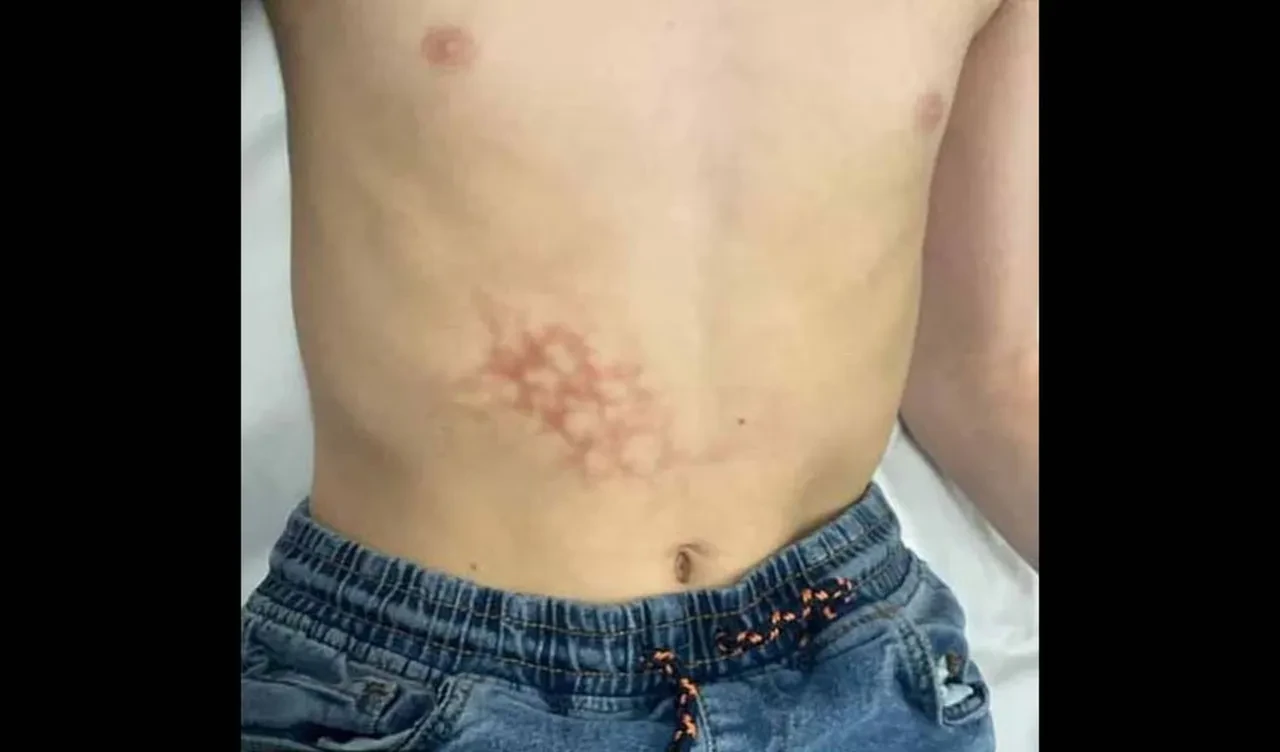 Dizüstü bilgisayarı karnına koyup saatlerce kullandı, hastanelik oldu