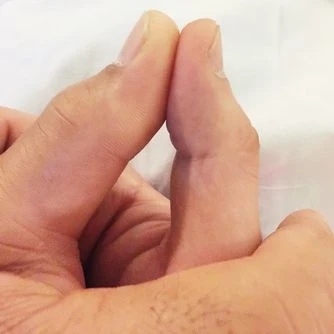 İbrahim Tatlıses'in ameliyat sonrası ilk fotoğrafı: Oğul İdo paylaştı