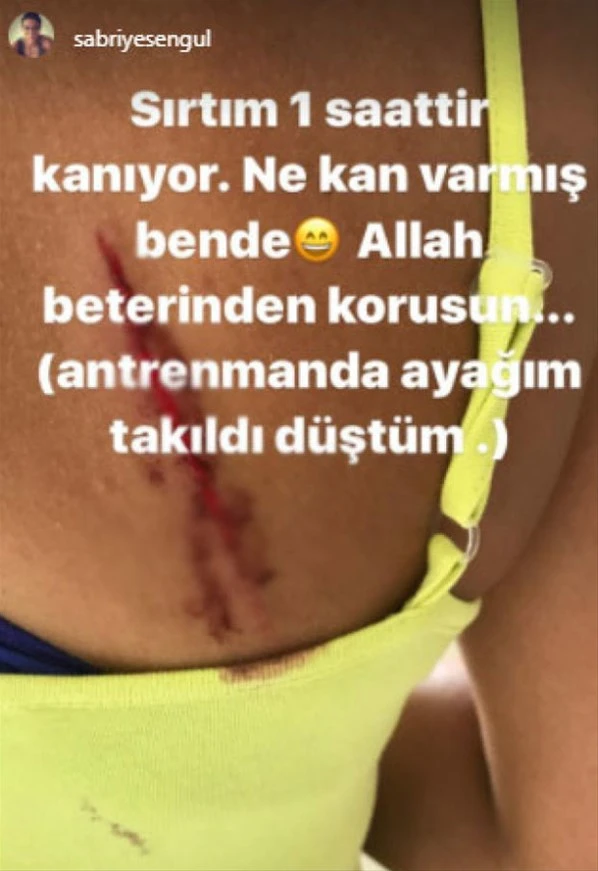 Survivor Sabriye'den antrenman sonrası şoke eden paylaşım: Sırtından yaralandı