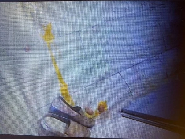 İstanbul'da komşu dehşeti: Kapı önüne bozuk yumurta, kimyasal ve dışkı attılar