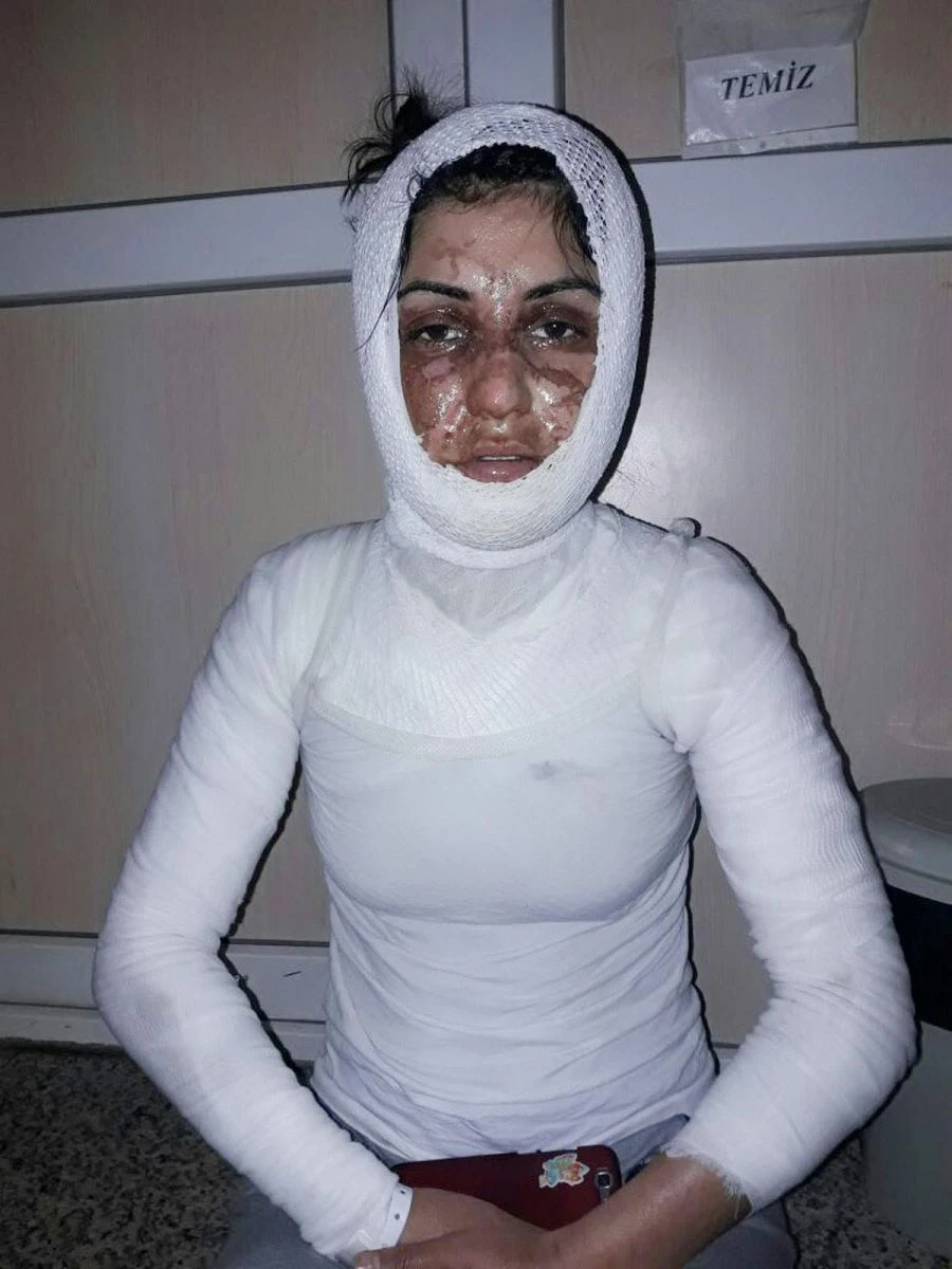 Uyuyan hala ve yeğene asitli saldırı