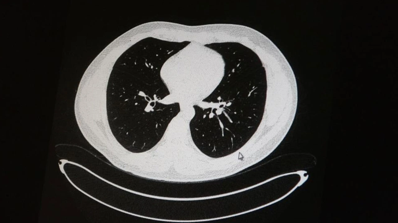 Korona geçiren aşılı ve aşısızların akciğerindeki büyük fark ortaya çıktı