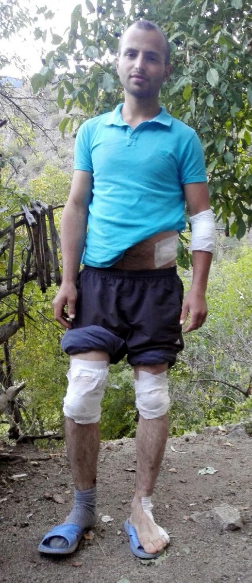 Ayı saldırısında bayılınca, ölümden kurtuldu