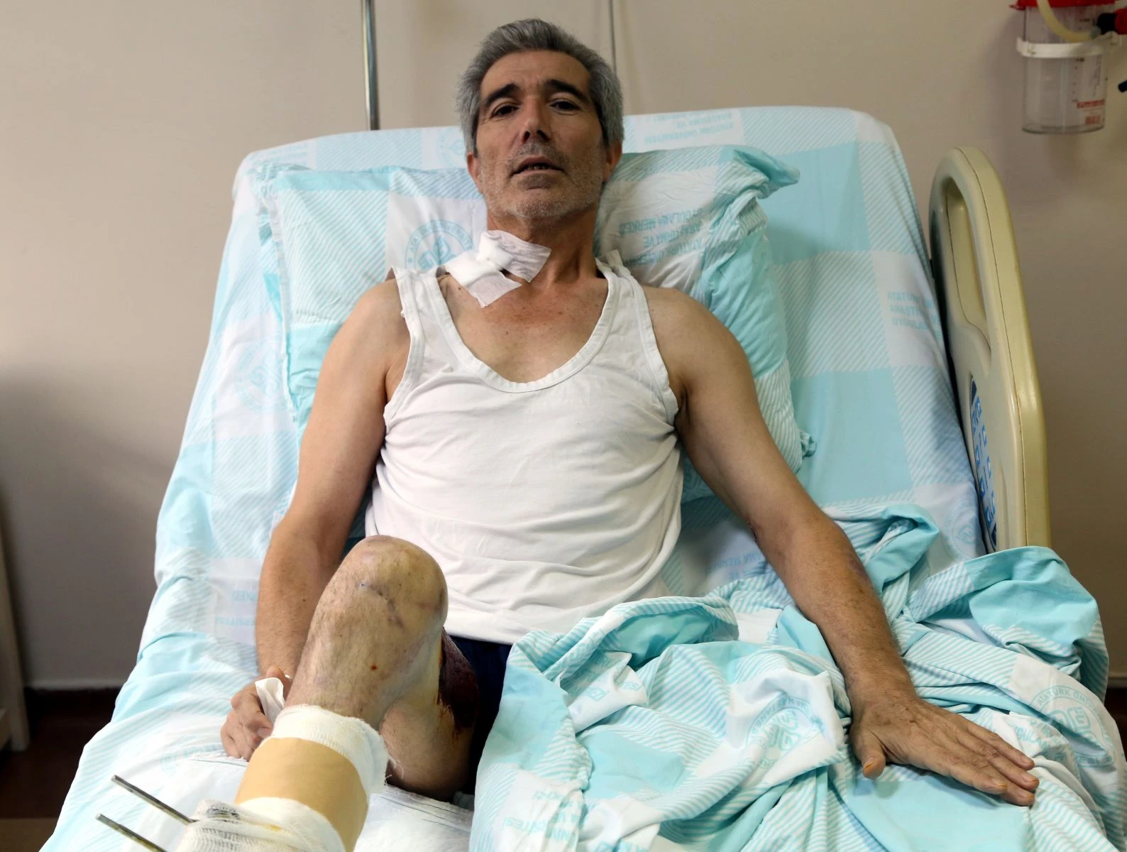 Doku nakli ile bacağı kesilmekten kurtuldu