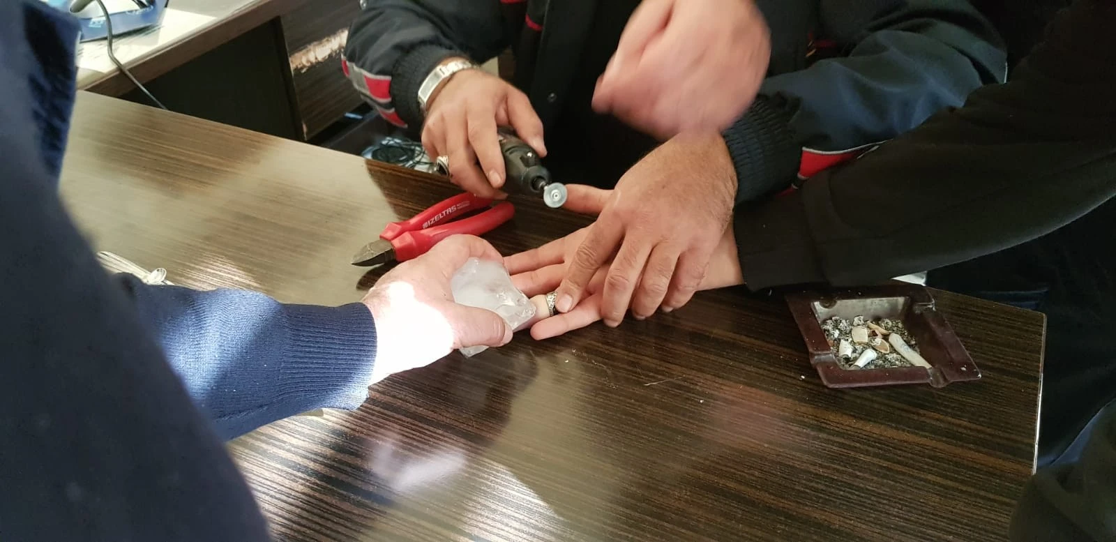 Parmağındaki yüzüğü itfaiye zor çıkarttı