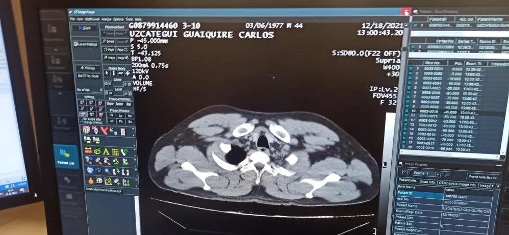 Uyuşturucu bağırsaklarında patlayınca yakayı ele verdi