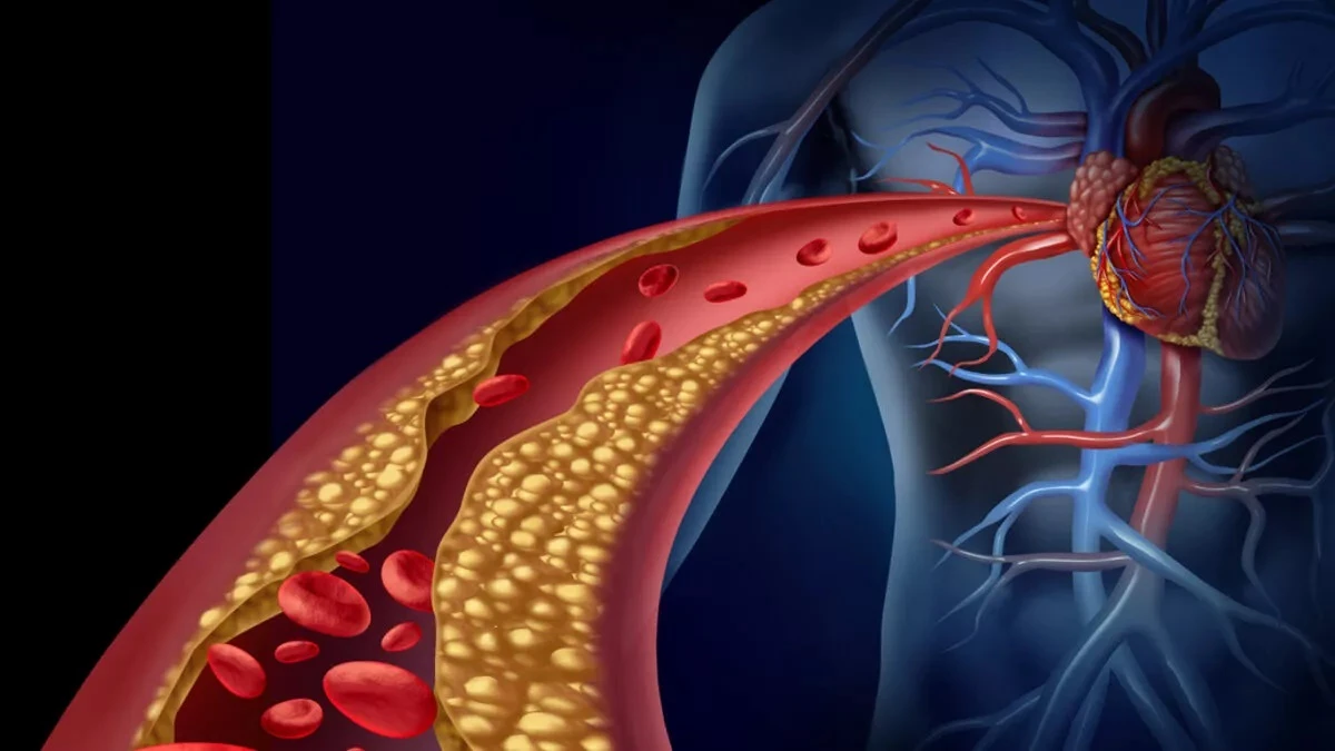 Buerger hastalığı nedir?