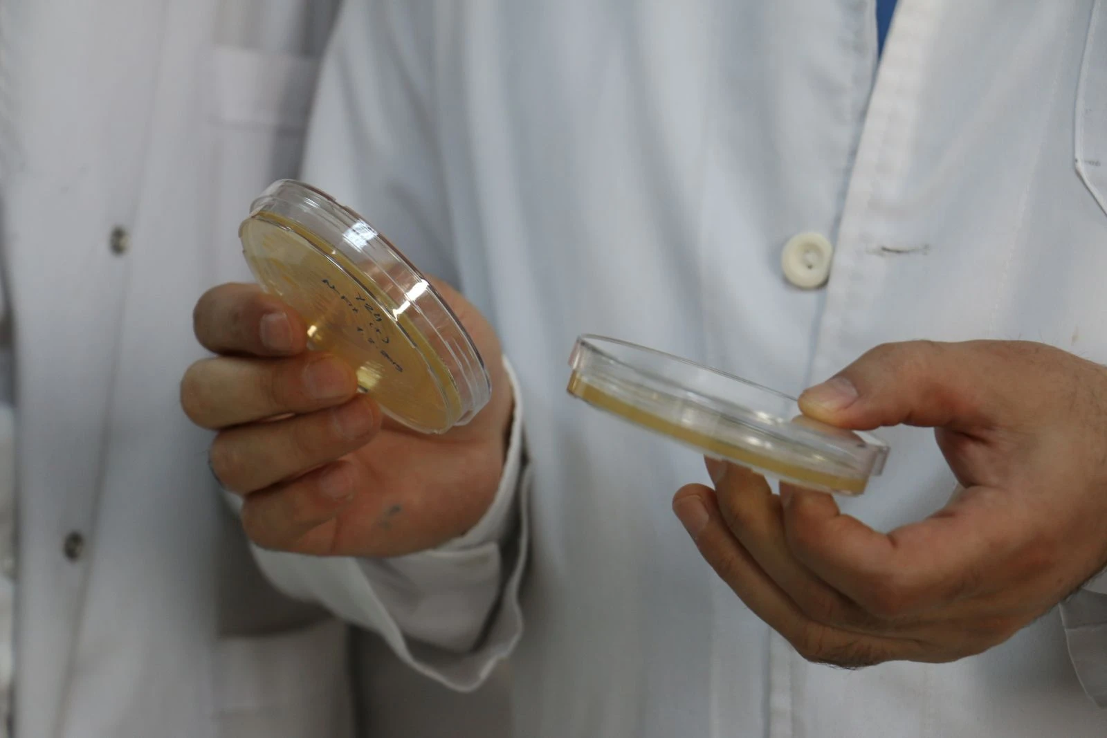 Erzurum'da yerli "nano-keratin" üretildi