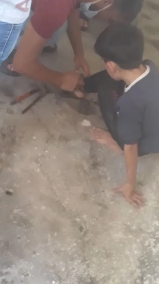 Ayağında zincirle alevler arasında kalan çocuğu itfaiye kurtardı