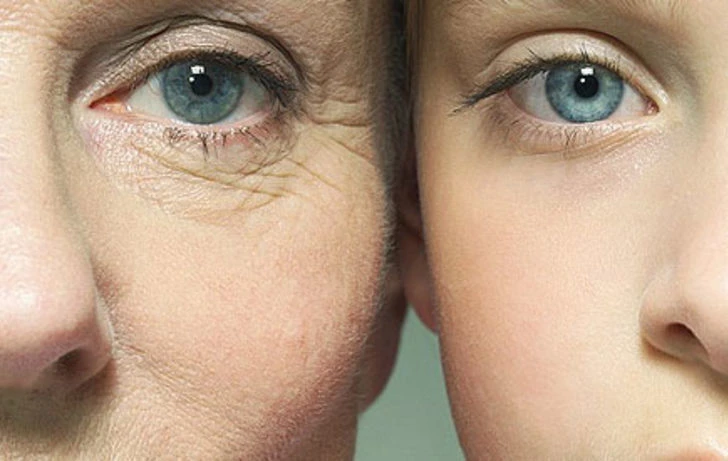 Sigara cildi nasıl etkiler?  Sigara bıraktıktan sonra cilt düzelir mi?