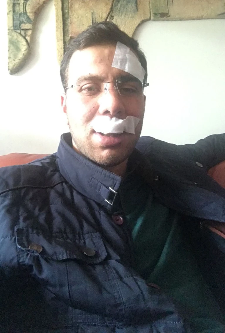 AK Partili Başkan trafik kazası geçirdi