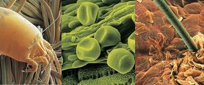 Alerji Nedir? Alerjen Nedir? Solunum Yolları Alerjilerinin Sebepleri Nelerdir?