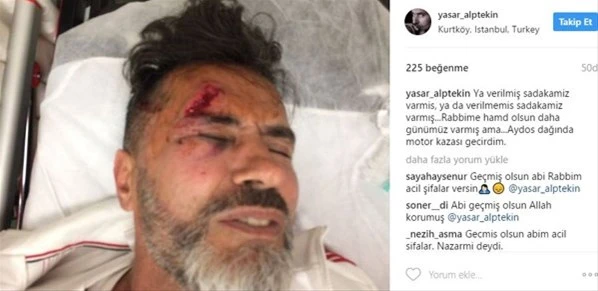 Yaşar Alptekin aydos dağında geçirdiği motor kazası sonrası sağlık durumu hakkında bilgi verdi
