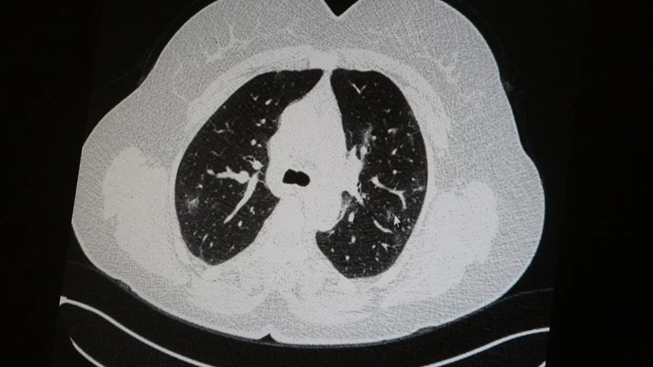Korona geçiren aşılı ve aşısızların akciğerindeki büyük fark ortaya çıktı